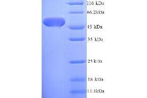 SDS-PAGE (SDS) image for SurA (AA 21-428) protein (His tag) (ABIN5714186) (SurA (AA 21-428) protein (His tag))