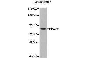 Western Blotting (WB) image for anti-Phosphoinositide 3 Kinase, p85 alpha (PI3K p85a) (AA 1-300) antibody (ABIN3020625) (PIK3R1 Antikörper  (AA 1-300))