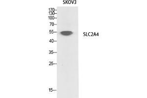 Western Blot analysis of SKOV3 cells using Glut4 Polyclonal Antibody. (GLUT4 Antikörper  (N-Term))