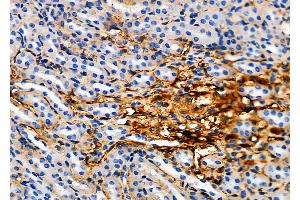 anti-Sialic Acid Binding Ig-Like Lectin 15 (SIGLEC15) antibody
