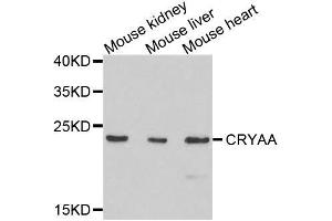 Western blot analysis of extracts of various cell lines, using CRYAA antibody. (CRYAA Antikörper  (AA 1-173))