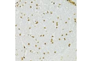 Immunohistochemistry of paraffin-embedded mouse brain using ADAR antibody (ABIN5975213) at dilution of 1/100 (40x lens). (ADAR Antikörper)