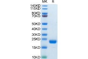 SDS-PAGE (SDS) image for Membrane-Spanning 4-Domains, Subfamily A, Member 1 (MS4A1) (AA 141-188) protein (His-Avi Tag,Biotin) (ABIN7274103)