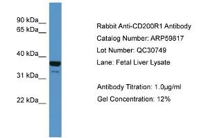 WB Suggested Anti-CD200R1  Antibody Titration: 0. (CD200R1 Antikörper  (N-Term))