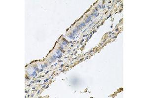 Immunohistochemistry of paraffin-embedded human trachea using DSG1 antibody. (Desmoglein 1 Antikörper  (AA 800-1049))