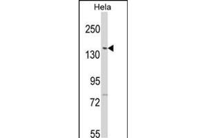 Western blot analysis of LTK2 N-term (ABIN391208 and ABIN2841288) in Hela cell line lysates (35 μg/lane). (LMTK2 Antikörper  (N-Term))