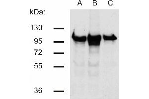 Western blotting analysis of beta-catenin in murine 3T3 (A), C57 (B) and KW1 (C) cell lines using antibody. (beta Catenin Antikörper)
