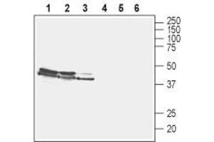 Western Blotting (WB) image for anti-Solute Carrier Family 17 (Vesicular Glutamate Transporter), Member 6 (SLC17A6) (AA 45-56), (Cytosolic) antibody (ABIN7043681)