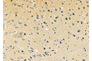 ABIN6263334 and ABIN6279547 at 1/100 staining Rat brain tissue by IHC-P.