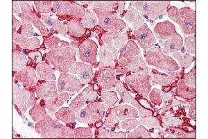 Image no. 3 for anti-Glutamic-Oxaloacetic Transaminase 1, Soluble (Aspartate Aminotransferase 1) (GOT1) (Internal Region) antibody (ABIN372773) (GOT1 Antikörper  (Internal Region))