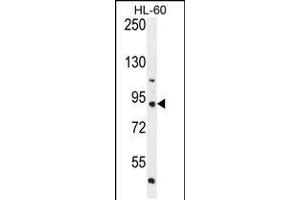 Western blot analysis in HL-60 cell line lysates (35ug/lane). (KIAA1586 Antikörper  (N-Term))