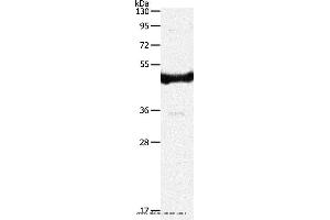 Western blot analysis of 293T cell, using IL11RA Polyclonal Antibody at dilution of 1:350 (IL11RA Antikörper)