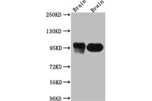 Western Blot Positive WB detected in: Rat Brain whole cell lysate, Mouse Brain whole cell lysate All lanes: PSD95 antibody at 1:1000 Secondary Goat polyclonal to rabbit IgG at 1/50000 dilution Predicted band size: 81, 86, 81 kDa Observed band size: 95 kDa (Rekombinanter DLG4 Antikörper)