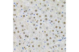 Immunohistochemistry of paraffin-embedded rat liver using SQSTM1 Antibody. (SQSTM1 Antikörper)