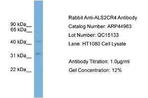 WB Suggested Anti-ALS2CR4  Antibody Titration: 0.