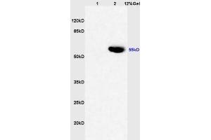 Lane 1: rat liver lysates Lane 2: human colon carcinoma lysates probed with Anti CYP3A4 Polyclonal Antibody, Unconjugated (ABIN733793) at 1:200 in 4 °C. (CYP3A4 Antikörper  (AA 18-120))