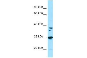 WB Suggested Anti-PPP1CB Antibody Titration: 1. (PPP1CB Antikörper  (C-Term))