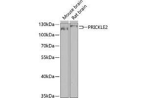 Western blot analysis of extracts of various cell lines, using PRICKLE2 antibody (ABIN6133166, ABIN6146162, ABIN6146163 and ABIN6224046) at 1:1000 dilution. (PRICKLE2 Antikörper  (AA 615-844))