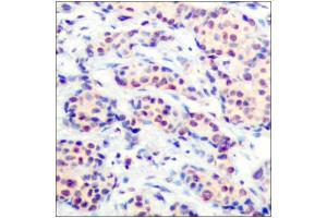 Immunohistochemistry (IHC) image for anti-Jun D Proto-Oncogene (JUND) (Ser255) antibody (ABIN1848124)