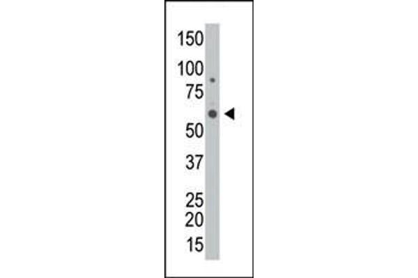 GALK2 Antikörper  (C-Term)