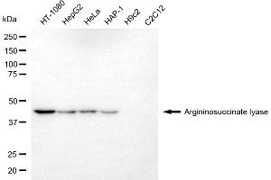 Western blotting analysis using argininosuccinate lyase antibody (ABIN7797646). (ASL Antikörper)