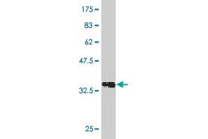 Western Blot detection against Immunogen (36. (Recoverin Antikörper  (AA 101-199))
