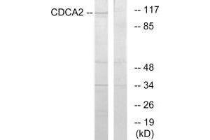 Western blot analysis of extracts from 293 cells, using CDCA2 antibody. (CDCA2 Antikörper  (C-Term))
