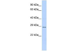 WB Suggested Anti-TFPI2 Antibody Titration: 0.