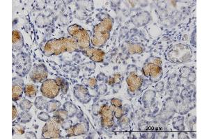 Immunoperoxidase of purified MaxPab rabbit antibody to MMP1 on formalin-fixed paraffin-embedded human colon. (MMP1 Antikörper  (AA 1-469))