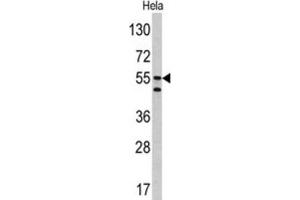 Western Blotting (WB) image for anti-Carbonic Anhydrase IX (CA9) antibody (ABIN3002202) (CA9 Antikörper)