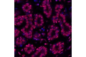 Immunofluorescence (IF) image for anti-gamma Histone Variant H2AX (GAMMA-H2AX) (Ser140) antibody (ABIN7454026) (Rekombinanter gamma H2AX Antikörper  (Ser140))