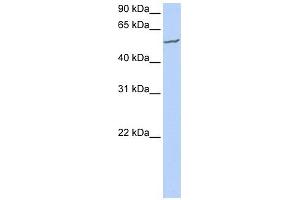 FBXW11 antibody used at 1 ug/ml to detect target protein. (FBXW11 Antikörper  (N-Term))
