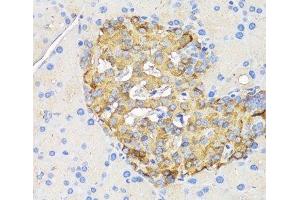 Immunohistochemistry of paraffin-embedded Rat pancreatic islet using INS Polyclonal Antibody at dilution of 1:50 (40x lens). (Insulin Antikörper)