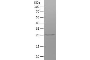 Western Blotting (WB) image for Immunoglobulin Heavy Constant gamma 1 (G1m Marker) (IGHG1) (AA 120-330) protein (His tag) (ABIN7123405)