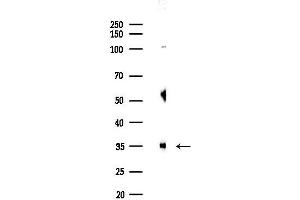 anti-UDP-Galactose-4-Epimerase (GALE) (C-Term) antibody
