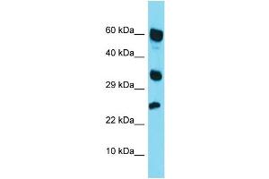 Western Blotting (WB) image for anti-Retinoic Acid Receptor Responder (Tazarotene Induced) 1 (RARRES1) (Middle Region) antibody (ABIN2788899) (RARRES1 Antikörper  (Middle Region))