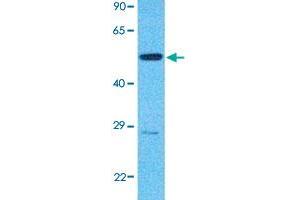 Western Blot analysis of human 786-O cell lysate with IKZF3 polyclonal antibody  at 1 ug/mL working concentration.