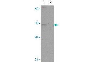 Western blot analysis of SLC39A3 in mouse lung tissue lysate with SLC39A3 polyclonal antibody  at 1 ug/mL in (1) the absence and (2) the presence of blocking peptide. (SLC39A3 Antikörper  (Internal Region))