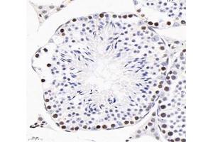 Immunohistochemistry analysis of paraffin-embedded mouse testis using,GINS2 (ABIN7074041) at dilution of 1: 3000 (GINS2 Antikörper)