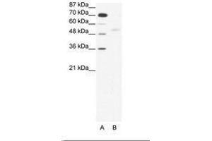 Image no. 1 for anti-SMAD, Mothers Against DPP Homolog 5 (SMAD5) (AA 193-242) antibody (ABIN203157) (SMAD5 Antikörper  (AA 193-242))