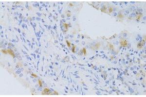 Immunohistochemistry (Paraffin-embedded Sections) (IHC (p)) image for anti-Cytochrome P450, Family 2, Subfamily C, Polypeptide 9 (CYP2C9) antibody (ABIN7262038)