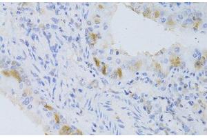 Immunohistochemistry of paraffin-embedded Mouse lung using CYP2C9 Polyclonal Antibody at dilution of 1:100 (40x lens). (CYP2C9 Antikörper)