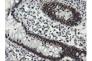 Image no. 1 for anti-Transducin-Like Enhancer of Split 1 (E(sp1) Homolog, Drosophila) (TLE1) (AA 180-460) antibody (ABIN1491049)