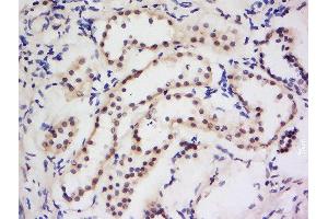 Formalin-fixed and paraffin embedded human kidney labeled with Anti-Dymeclin Polyclonal Antibody, Unconjugated  at 1:200 followed by conjugation to the secondary antibody and DAB staining. (Dymeclin Antikörper  (AA 151-250))