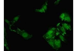 Immunofluorescent analysis of Hela cells using ABIN7161975 at dilution of 1:100 and Alexa Fluor 488-congugated AffiniPure Goat Anti-Rabbit IgG(H+L) (NOL4L (AA 101-300) Antikörper)
