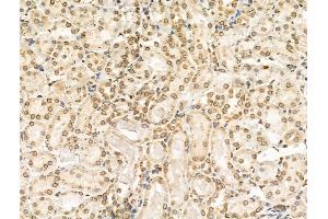 ABIN6257023 and ABIN6274557 at 1/100 staining Rat kidney tissue by IHC-P. (DYRK1B Antikörper  (Internal Region))