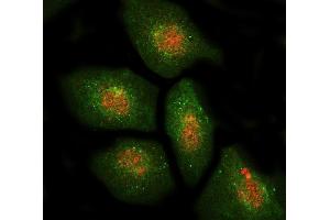 IF analysis of DBF4 using anti-DBF4 antibody (ABIN7601162) and anti-Beta Tubulin antibody (ABIN7602743). (DBF4 Antikörper  (AA 295-665))