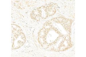 Immunohistochemistry (IHC) image for anti-RAD9 Homolog A (S. Pombe) (RAD9A) (C-Term) antibody (ABIN7454682) (RAD9A Antikörper  (C-Term))