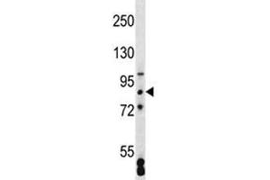 SATB2 antibody western blot analysis in MCF-7 lysate (SATB2 Antikörper  (AA 410-439))