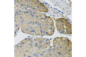 Immunohistochemistry of paraffin-embedded human stomach using THBS2 antibody. (Thrombospondin 2 Antikörper)